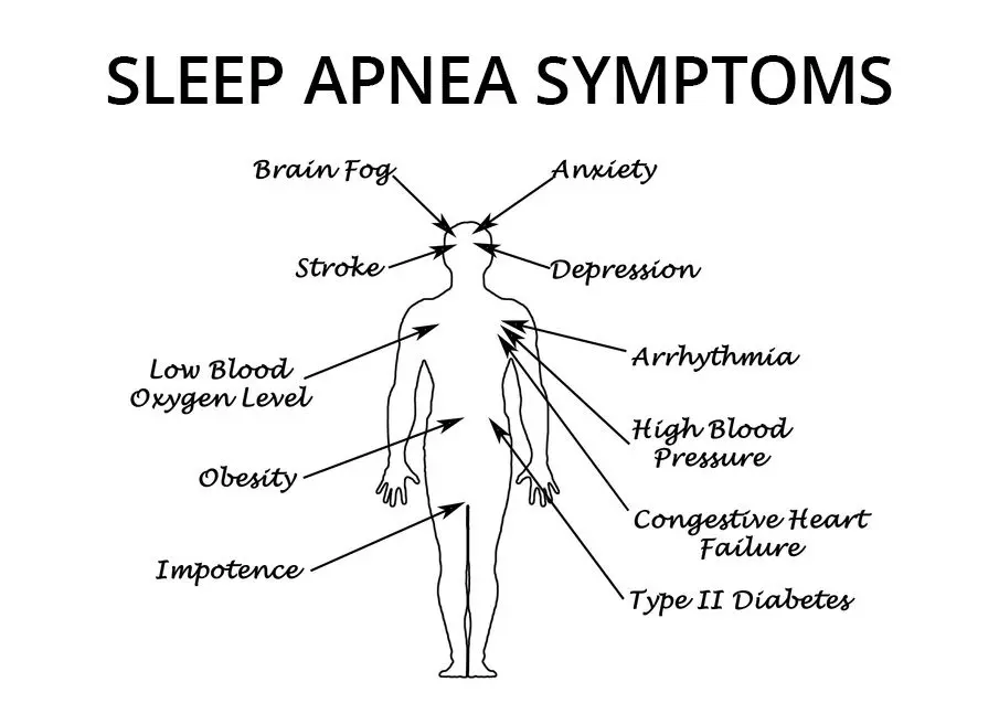 Symptoms of sleep apnea