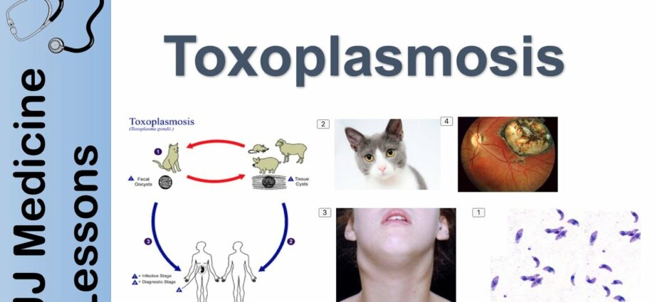 Comharthaí tocsoplasmosis (tocsoplasma)