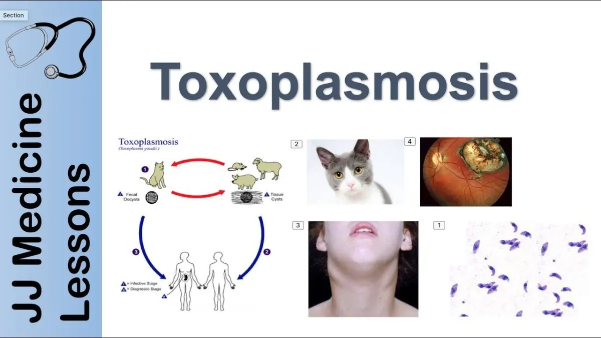 Symptoms of toxoplasmosis (toxoplasma)