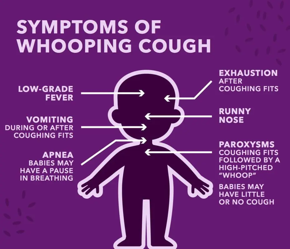 Symptoms of whooping cough