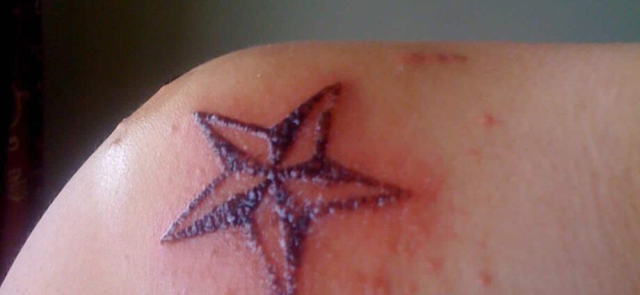 Tattoo ink allergy: o a ni a'afiaga?