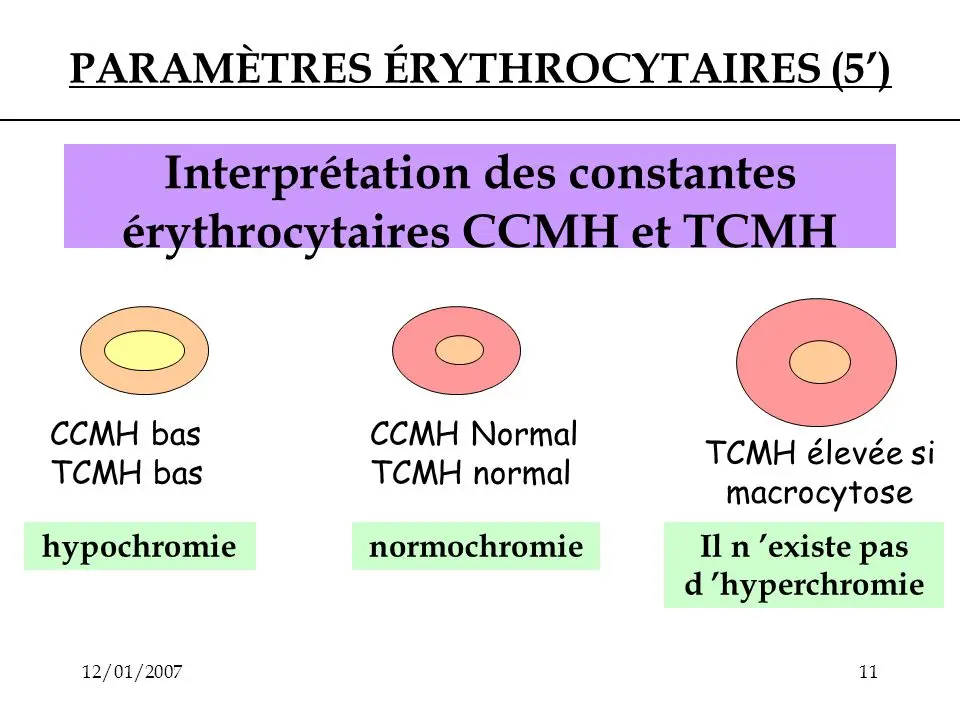 TCMH (MCHC): normal value?