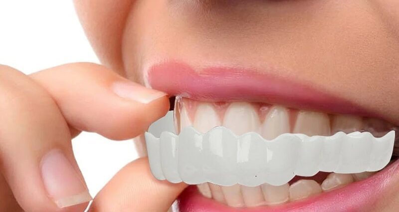 Teeth whitening: Hollywood smile, beautiful teeth, ultrasonic cleaning, the secret of whiteness