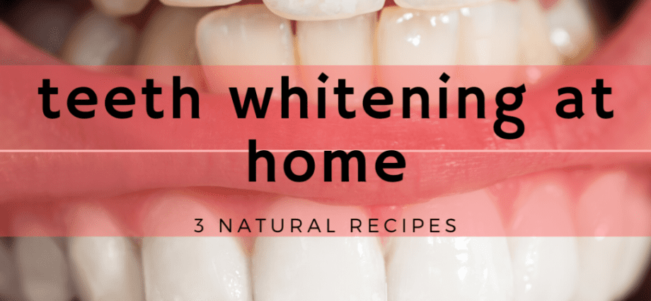 Izbjeljivanje zubi: domaći recepti