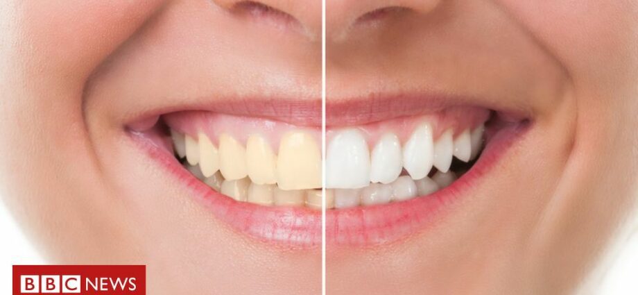 Teeth whitening: is it dangerous?