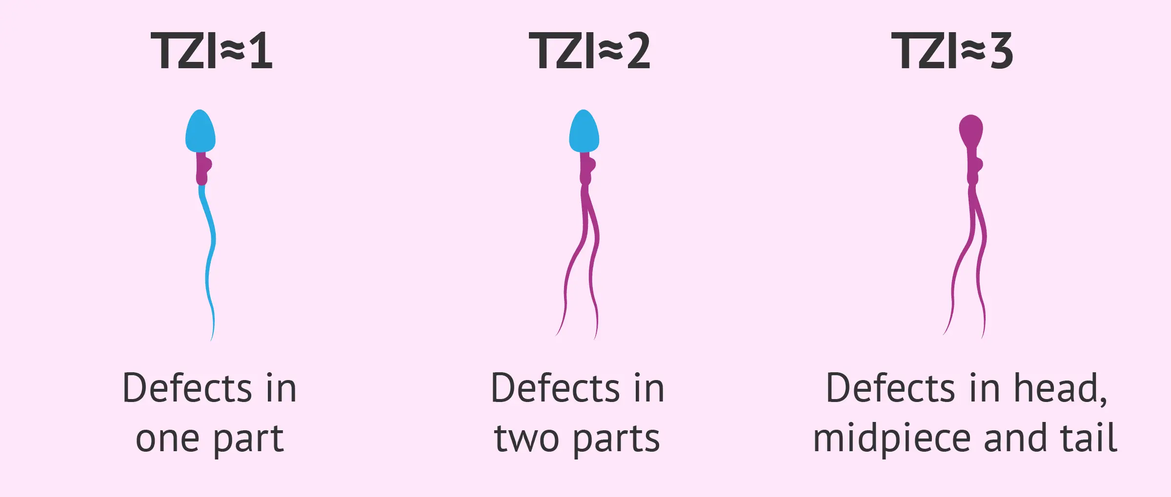 Teratospermia: definition, causes, symptoms and treatment