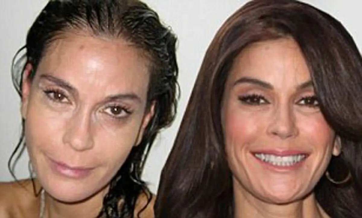Teri Hatcher after Botox injection. Photo