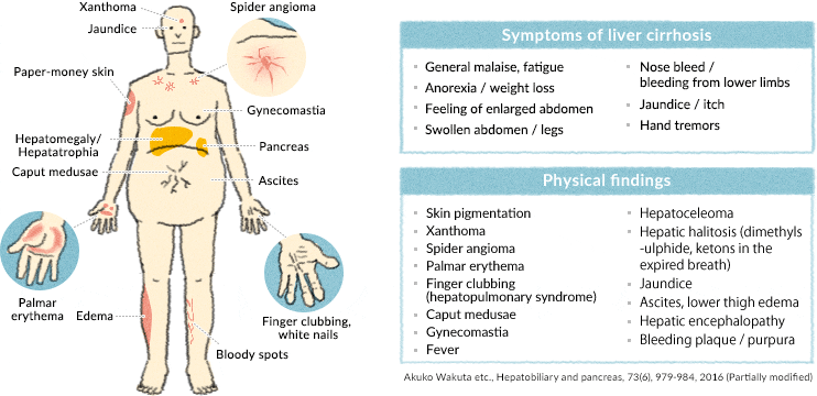 Tests for the liver: signs of illness, where to check the liver?