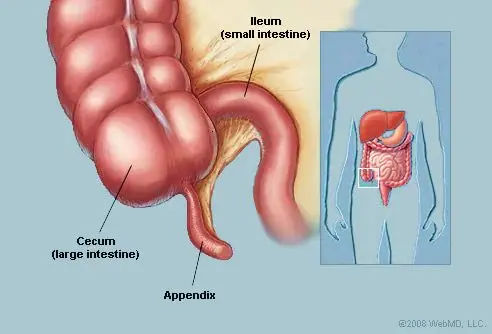 The appendix