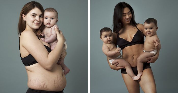 The body of a mother with many children after childbirth &#8211; photo