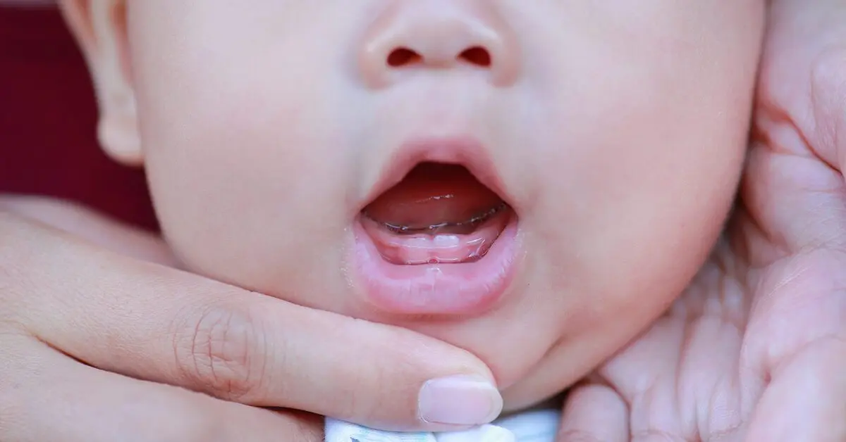 The child&#8217;s teeth are not teething in any way: what to do