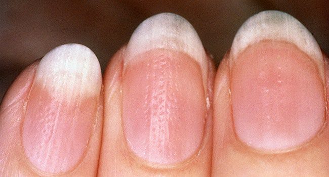 The condition of your nails will tell you about your health