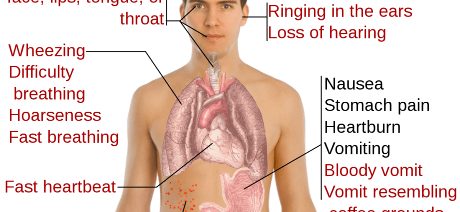 The effect of aspirin on the body