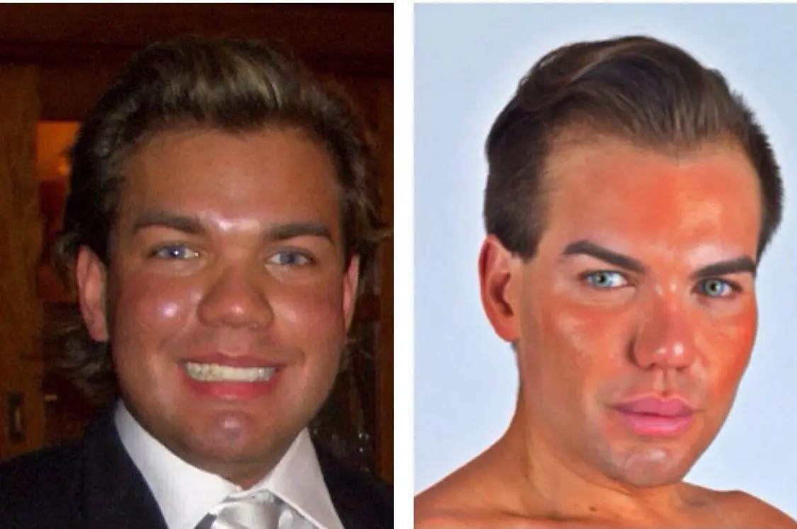 The evolution of living Ken: before and after photos