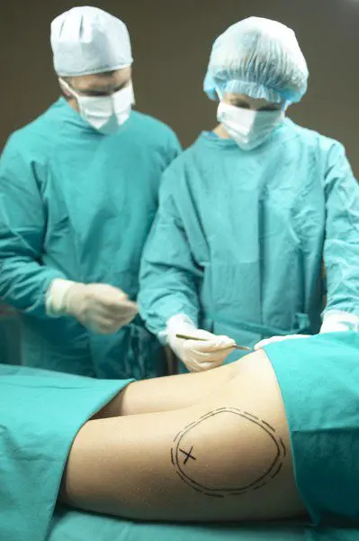 The girl required emergency treatment after buttock augmentation surgery