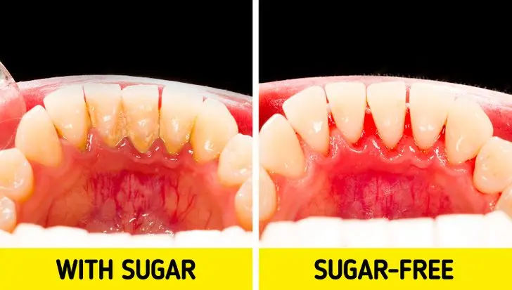 The harm of chewing gum