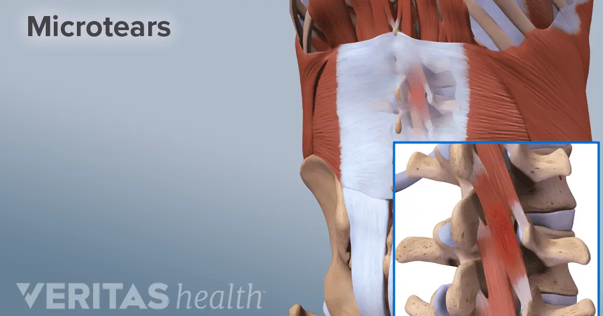 The lower back hurts and pulls: the reasons. Video