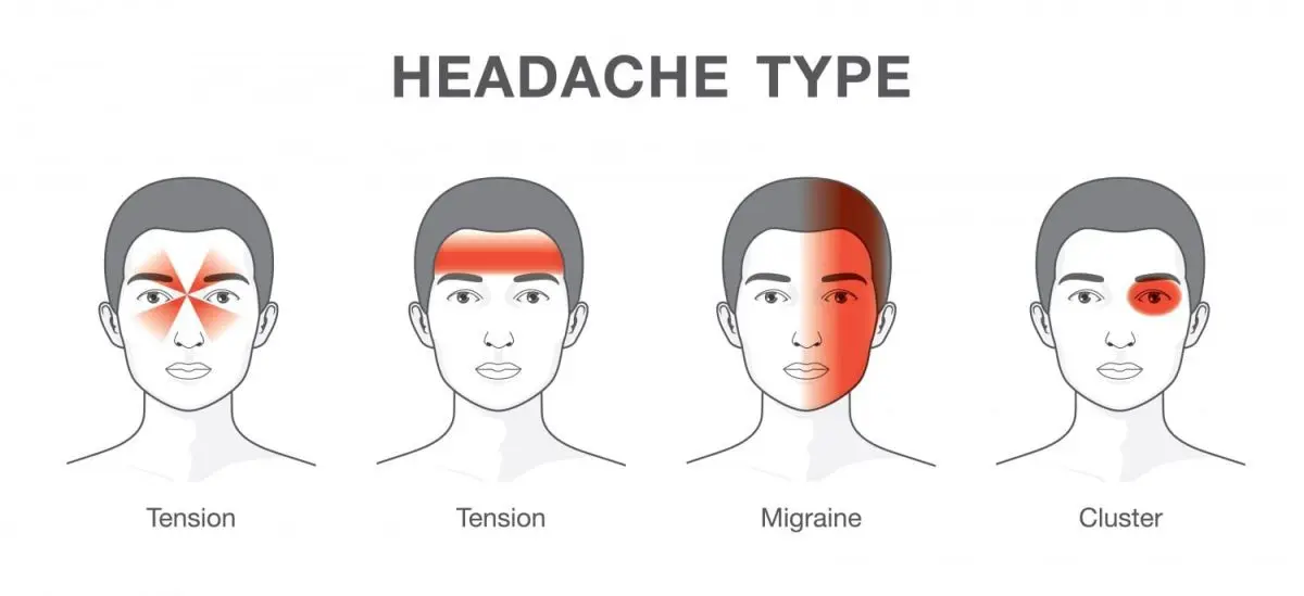 The migraine, that headache &#8230;