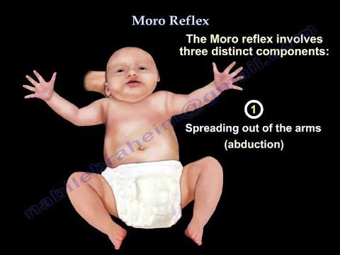 The moro reflex: what is it?