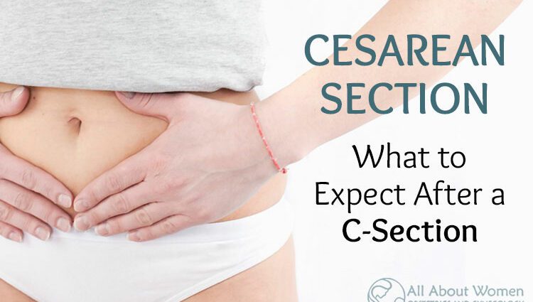 The post-cesarean section: treating the post-cesarean scar