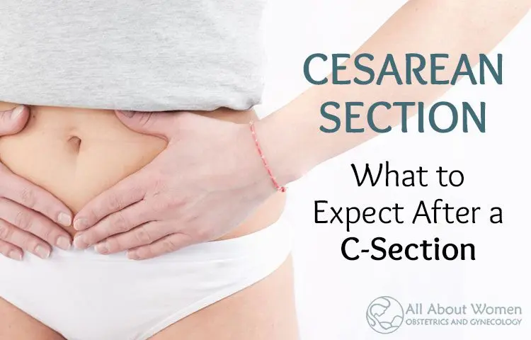 The post-cesarean section: treating the post-cesarean scar