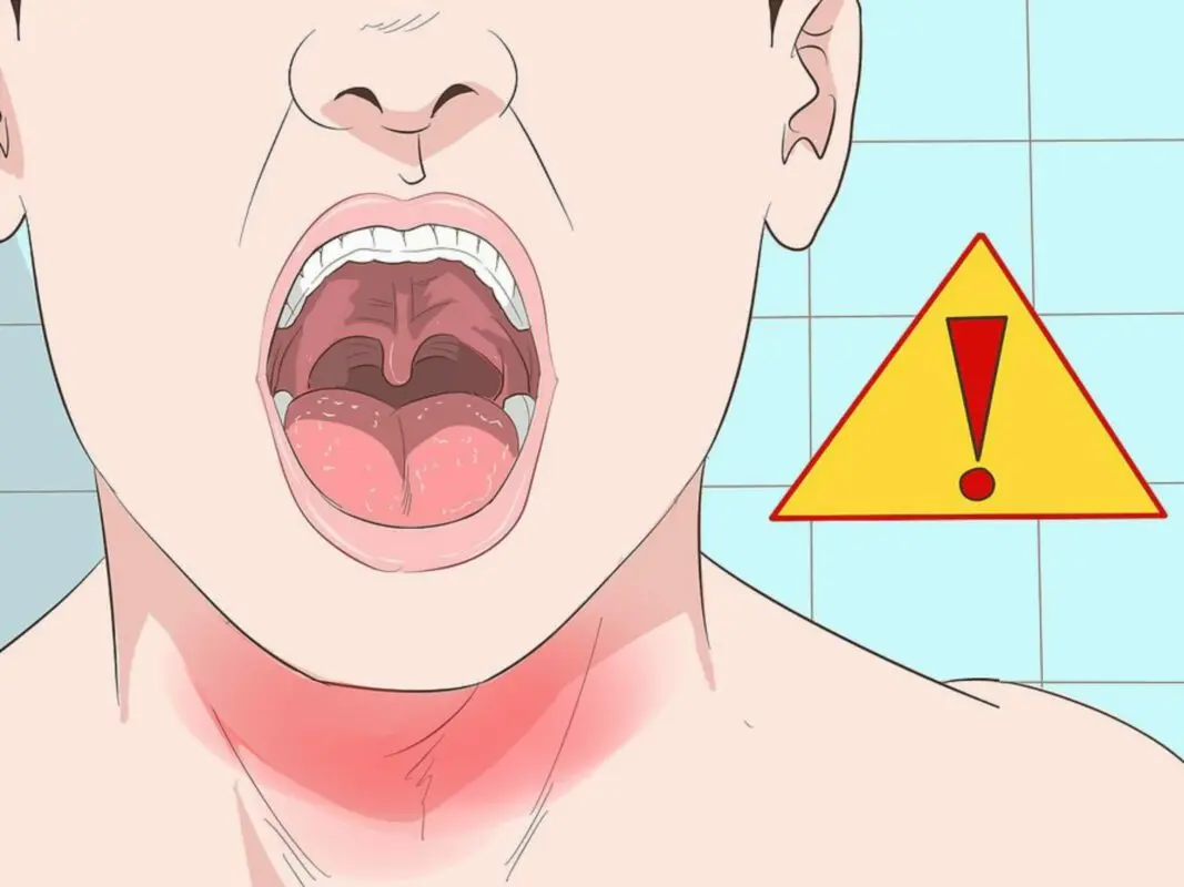 The right step towards sore throat relief