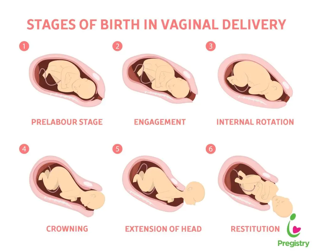 The stages of childbirth: arrival at the maternity ward