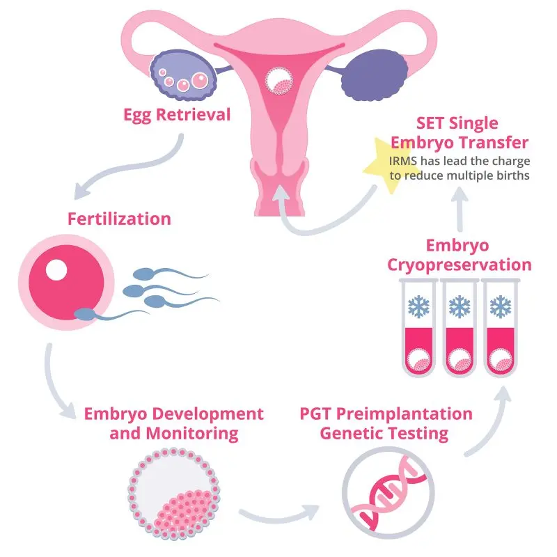 The stages of in vitro fertilization (IVF)