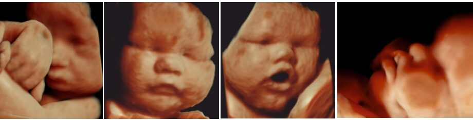 The third ultrasound: all about the last pregnancy ultrasound – Healthy ...