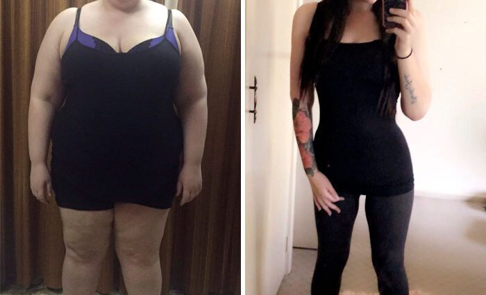 La donna è caduta di 60 chili dopo 9 parti: foto prima e dopo