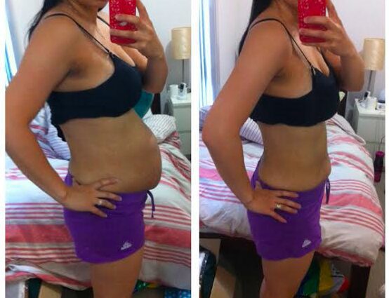 The woman lost 70 kg after giving birth, personal experience, before and after photos