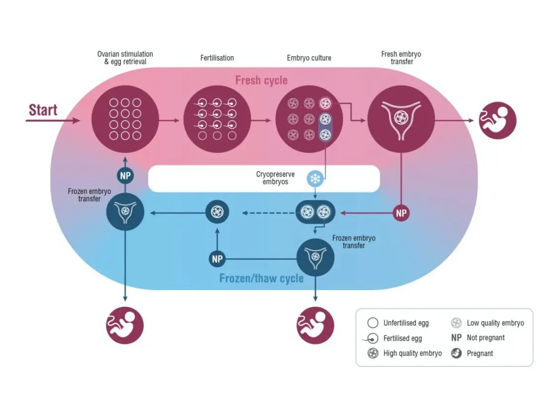 There are chances: how infertility was treated then and now