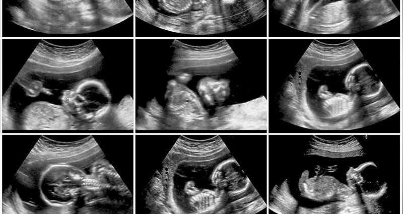 Chechitatu trimester yepamuviri: inotanga vhiki ipi, ultrasound, toni