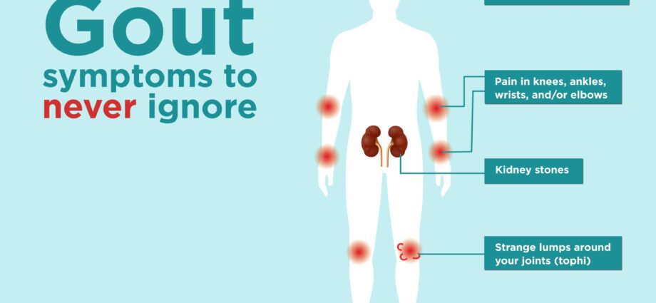 This awkward moment: belching and 8 more subtle symptoms and consequences of COVID-19