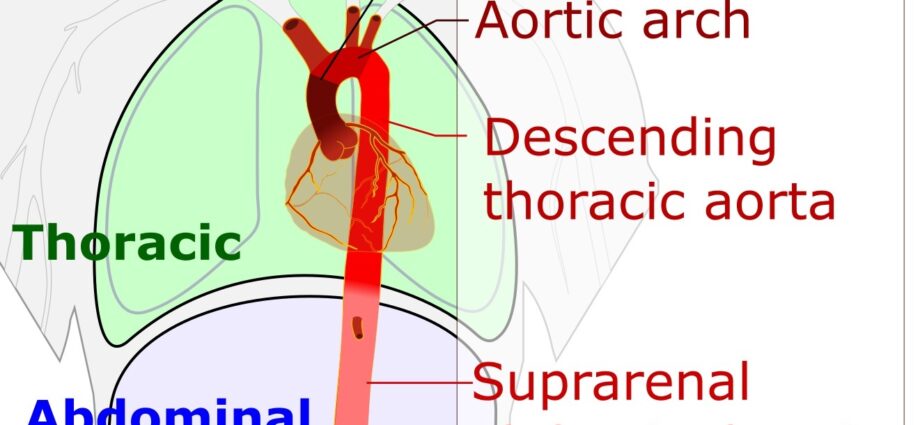 Aorta torácica