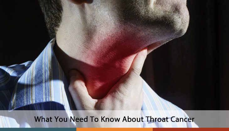 Throat cancer &#8211; Our doctor&#8217;s opinion