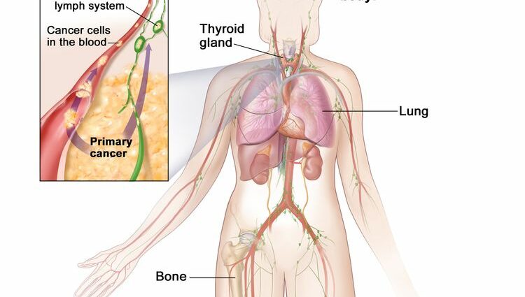 Ailse Thyroid - Láithreáin Spéise