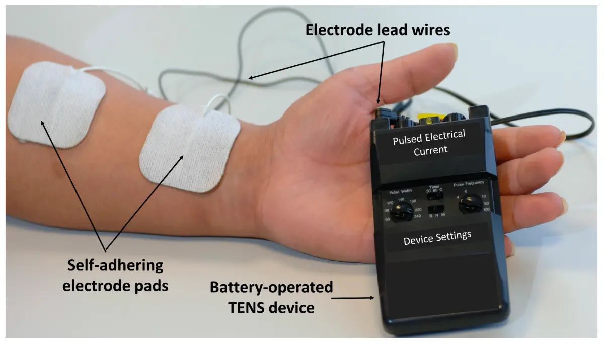 Transcutaneous electrical nerve stimulation (TENS)