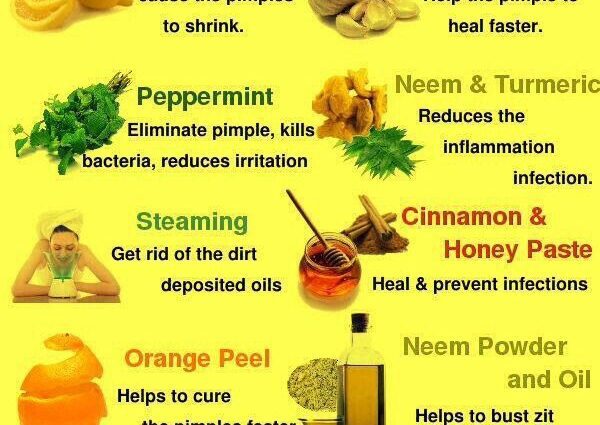 Treating acne and acne (pimples) at home