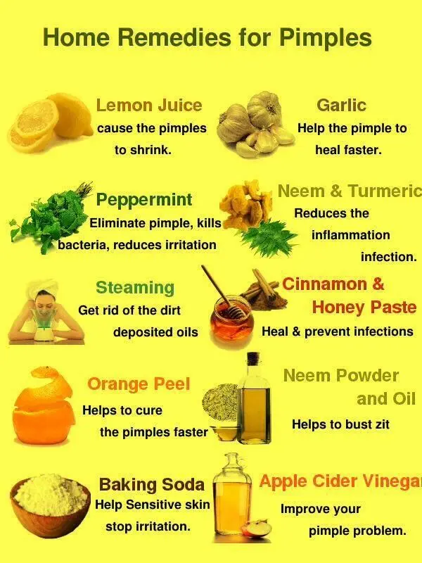 Treating acne and acne (pimples) at home