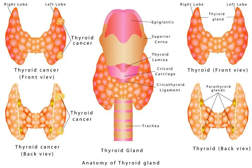 Treatments for thyroid cancer