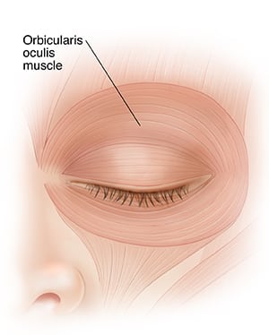 Tremor eyelids: fasciculations