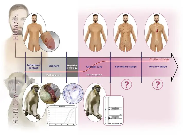 Treponematosis and treponemosis: what are these diseases?