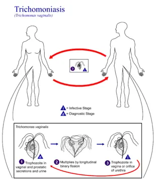 Trichomoniasis: symptoms and transmission