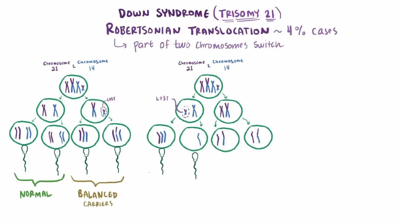 Trisomy 21 &#8211; Sites of interest and support groups