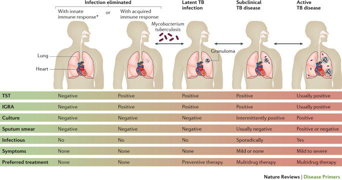 Tuberculosis &#8211; Sites of interest