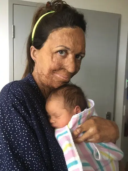 Turia Pitt gave birth to a son: latest news 2017