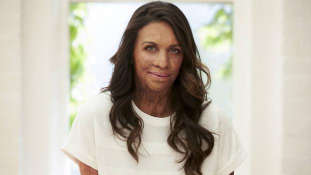 Turia Pitt: &#8220;Instead of obsessing over what happened to me, I directed my energy to create a good life for myself&#8221;