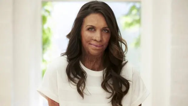 Turia Pitt: &#8220;Instead of obsessing over what happened to me, I directed my energy to create a good life for myself&#8221;