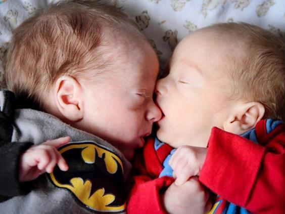 Twins could have died before birth if they hadn&#8217;t hugged